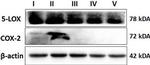 Mouse IgG (H+L) Secondary Antibody in Western Blot (WB)