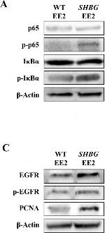 Rabbit IgG (H+L) Secondary Antibody in Western Blot (WB)