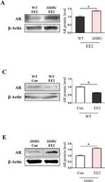 Rabbit IgG (H+L) Secondary Antibody in Western Blot (WB)