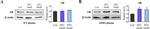 Rabbit IgG (H+L) Secondary Antibody in Western Blot (WB)