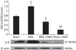 IL-6 Antibody in Western Blot (WB)