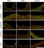 CD106 (VCAM-1) Antibody in Immunohistochemistry (IHC)