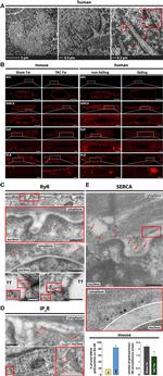 SERCA2 ATPase Antibody in Immunocytochemistry (ICC/IF)