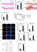 Galectin 3 Antibody in Immunohistochemistry (IHC)