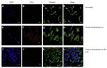 EEA1 Antibody in Immunocytochemistry (ICC/IF)