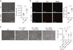 MCP-1 Antibody in Neutralization (Neu)