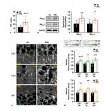 Prolactin Receptor Antibody in Western Blot (WB)