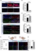 IL-20 Antibody in Immunohistochemistry (IHC)