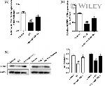 ALPK3 Antibody in Western Blot (WB)