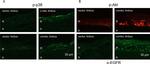 Phospho-EGFR (Tyr845) Antibody in Immunohistochemistry (IHC)