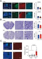 GFAP Antibody in Immunohistochemistry (IHC)