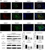 NLRP3 Antibody in Western Blot, Immunoprecipitation (WB, IP)