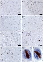 VCP Antibody in Immunohistochemistry (IHC)