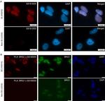 BRG1 Antibody in Proximity Ligation Assay (PLA) (PLA)