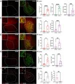 SOD1 Antibody in Immunohistochemistry (IHC)