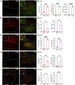 PRDX5 Antibody in Immunohistochemistry (IHC)