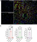 SOD1 Antibody in Immunohistochemistry (IHC)