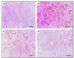 TNF alpha Antibody in Immunohistochemistry (IHC)