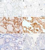 ACE2 Antibody in Immunohistochemistry (IHC)