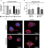 Caveolin 1 Antibody in Immunocytochemistry (ICC/IF)