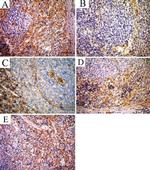 beta Actin Antibody in Immunohistochemistry (IHC)