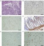 CD68 Antibody in Immunohistochemistry (Paraffin) (IHC (P))