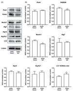 Parkin Antibody in Western Blot (WB)