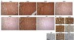 PADI6 Antibody in Immunohistochemistry (IHC)