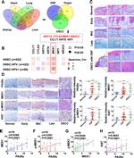 PSME3 Antibody in Immunohistochemistry (IHC)