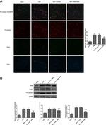 TXNIP Antibody in Western Blot (WB)