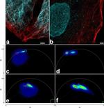 Vimentin Antibody in Immunocytochemistry (ICC/IF)