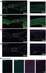 Aggrecan Antibody in Immunohistochemistry (IHC)