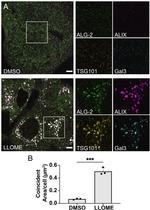 Alix Antibody in Immunocytochemistry (ICC/IF)