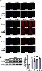 PDGFRA Antibody in Immunohistochemistry (IHC)