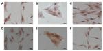 Alpha-Smooth Muscle Actin Antibody in Immunocytochemistry (ICC/IF)