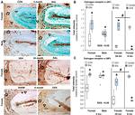 Estrogen Receptor alpha Antibody in Immunohistochemistry (IHC)