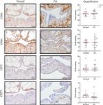 CD271 (NGF Receptor) Antibody in Immunohistochemistry (IHC)