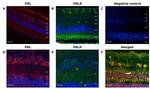 Prolactin Receptor Antibody in Immunohistochemistry (IHC)