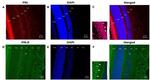 Prolactin Receptor Antibody in Immunohistochemistry (IHC)