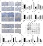 HO-1 Antibody in Western Blot, Immunohistochemistry (WB, IHC)