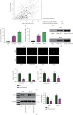 MCP-3 Antibody in Western Blot (WB)