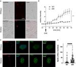 NEFM Antibody in Immunocytochemistry (ICC/IF)