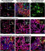 CD140b (PDGFRB) Antibody in Immunocytochemistry (ICC/IF)