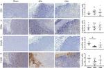 CD8a Antibody in Immunohistochemistry (IHC)