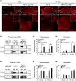 Tau Antibody in Immunohistochemistry (IHC)