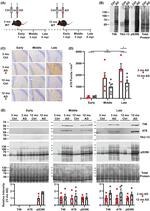 Tau Antibody in Western Blot (WB)