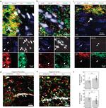 Synaptophysin Antibody in Immunohistochemistry (IHC)