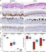 FOXJ1 Antibody in Immunohistochemistry (IHC)