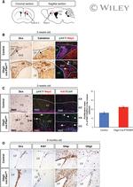 Calretinin Antibody in Immunohistochemistry (IHC)