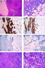 Calretinin Antibody in Immunohistochemistry (IHC)